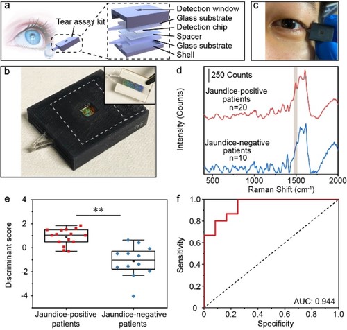 样品采集与分离一体化的泪液检测试剂盒